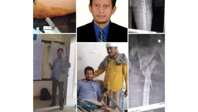تعرض الحقوقي والمجتمعي أ. سليم النجاشي لحادث سقوط وهو يحضر إحدى فعاليات الصندوق الإجتماعي للتنمية فرع عدن 2