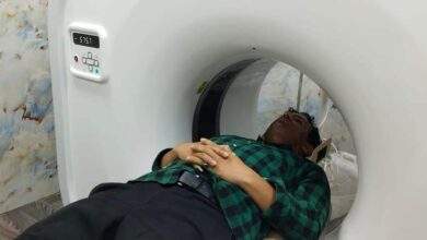 نقابة الصحفيين اليمنيين تدين الاعتداء على رسام الكاريكاتير هلال المرقب 2