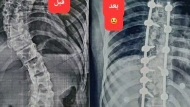 إنجاز طبي تاريخي في عدن 9