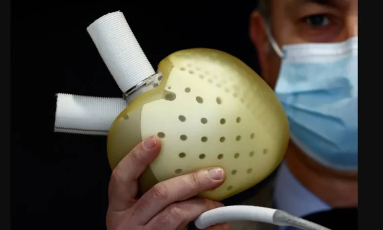 6 أطعمة مذهلة تحافظ على شرايين القلب وتقي من السكتة الدماغية 3