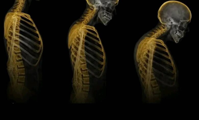 اختراق علمي: علاج جيني جديد يعيد بناء العظام ويقلب موازين علاج هشاشة العظام 7