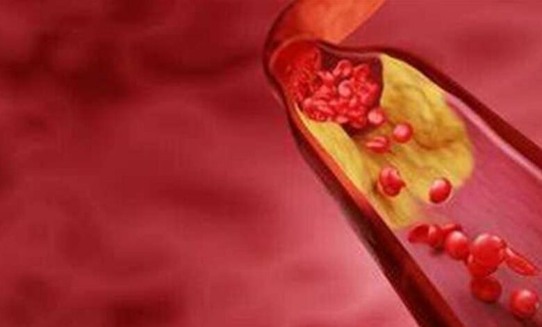 أفضل 5 أطعمة طبيعية تنظيف الشرايين وتعزز صحة الدورة الدموية 10