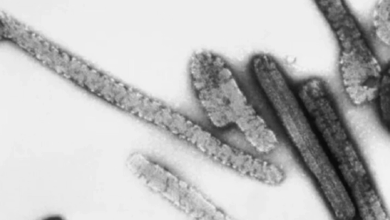 تحذير عاجل من الصحة العالمية: انتشار فيروس قاتل يثير القلق عالمياً 2