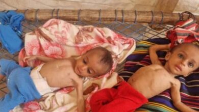 تقرير أممي: تفاقم سوء التغذية بين الأطفال في اليمن 3