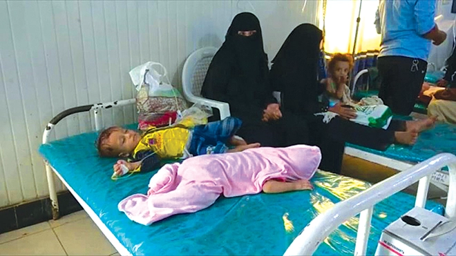 الحمّى الشوكية تنتشر بصمت.. خطر قاتل يهدد أطفال اليمن!