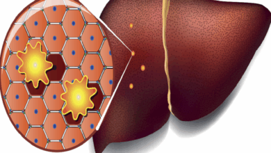 تحذير صحي جديد: الأطعمة الدهنية قد تفتح أبواب السرطان للكبد 3