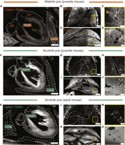 ثورة في الطب: تقنية تكشف لأول مرة مسار كل حبة دواء داخل جسم الإنسان! 2