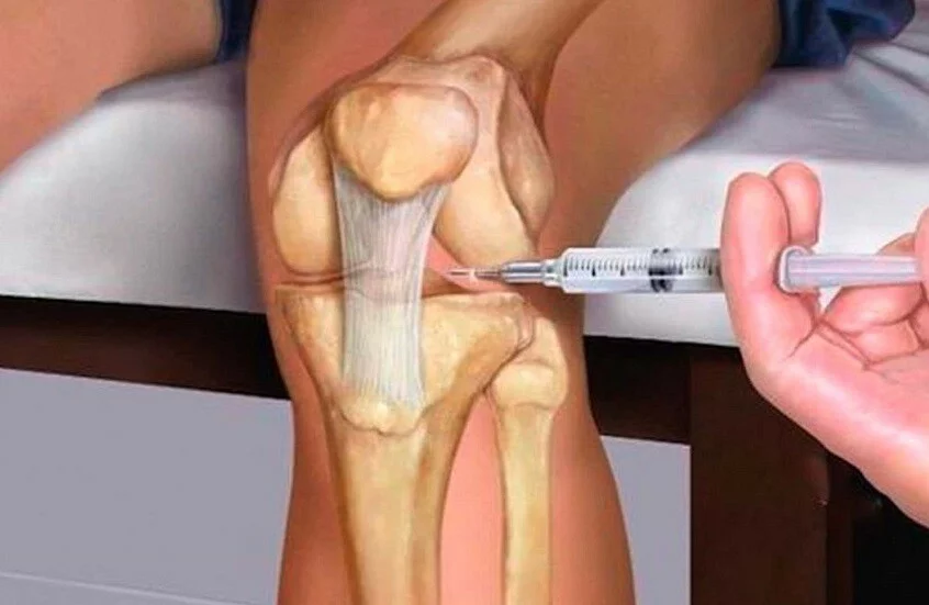 ثورة طبية: دواء جديد يعيد بناء الغضروف التالف ويعيد حركتك! 1