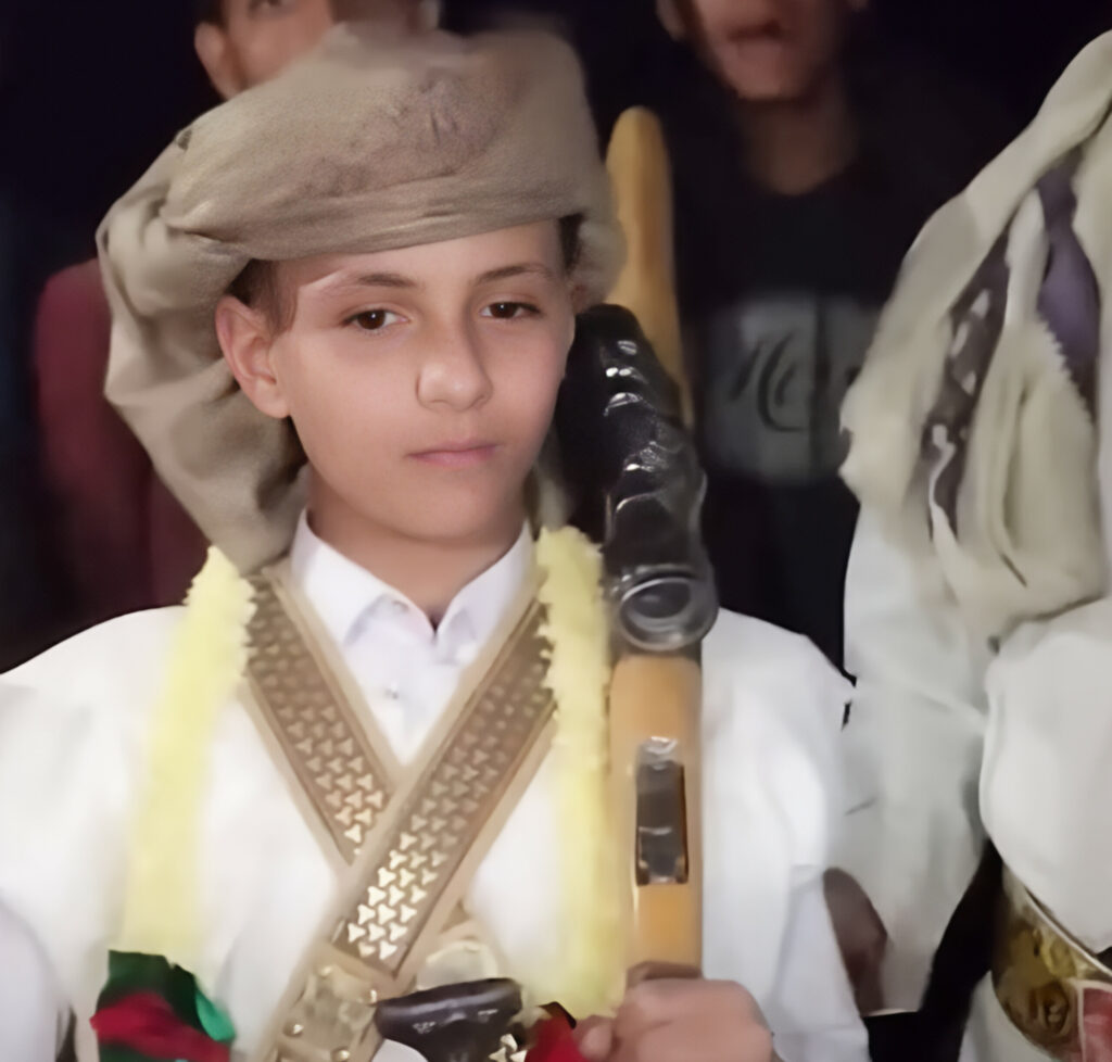 زواج طفل في حجة يثير الجدل: حقوقيون يطالبون بسن قوانين لحماية الطفولة