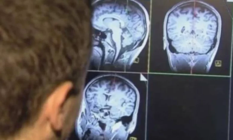 تطور علمي صادم: تحويل الدماغ الحي إلى شفاف يغير مستقبل الطب 2