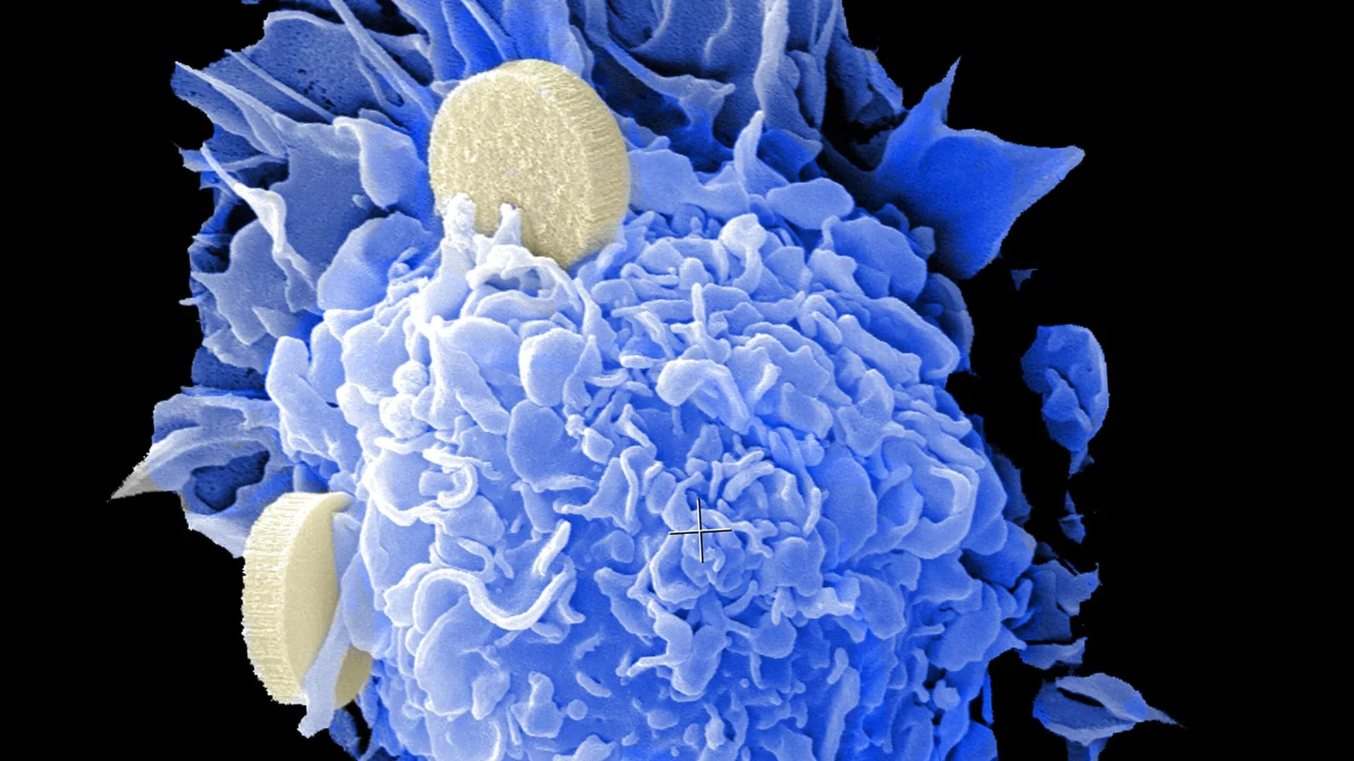 دراسة حديثة تكشف: الزواج قد يقلل خطر الإصابة بالسرطان بشكل ملحوظ 1