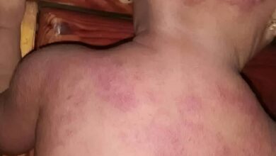 أجساد الأطفال تدفع الثمن.. غضب واسع في عدن بسبب انهيار الكهرباء 2