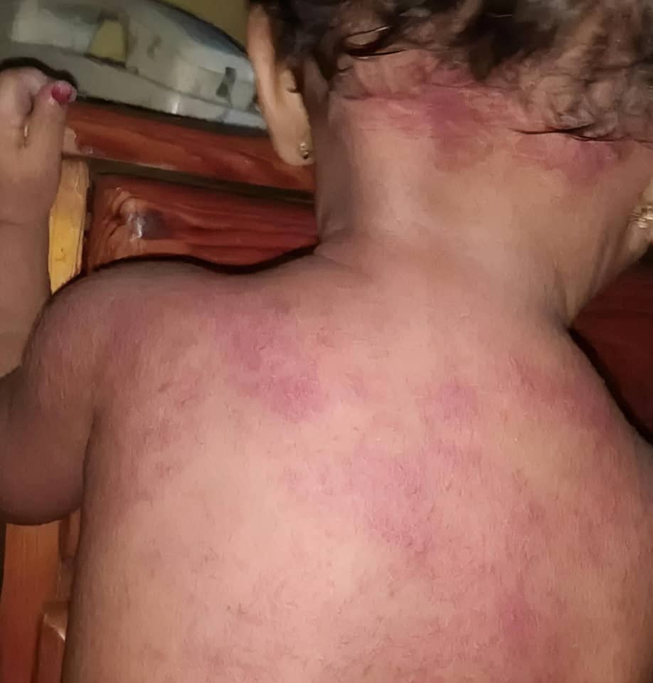 أجساد الأطفال تدفع الثمن.. غضب واسع في عدن بسبب انهيار الكهرباء 1