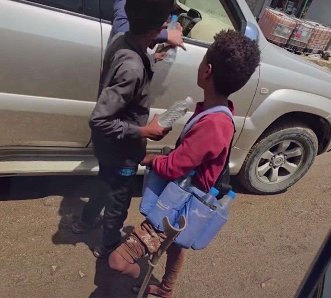 طفل مبتور الساق يبيع المياه في تعز.. مشهد يهز القلوب ويكشف قسوة الحرب 1