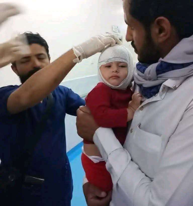 قصف حوثي يستهدف مخيمات النازحين في مأرب.. وناشطون يتداولون صورة طفل مصاب 1