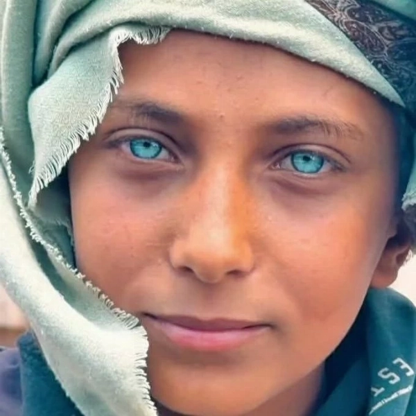 مراهق يمني بعيون زرقاء يشعل مواقع التواصل.. ملايين المشاهدات خلال أيام 1